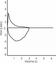 <strong>Which answer is consistent with the flow-volume curve shown? </strong> A) Normal forced expiratory flow pattern B) Variable intrathoracic obstruction C) Airway obstruction D) Fixed extrathoracic obstruction
