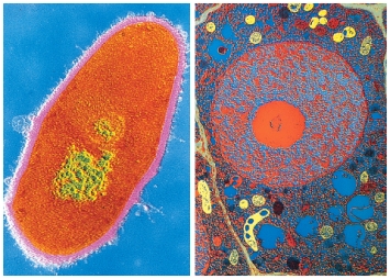 How do eukaryotes,as seen on left,differ from bacteria and Archaea (i.e.prokaryotes),such as the one pictured at right?
