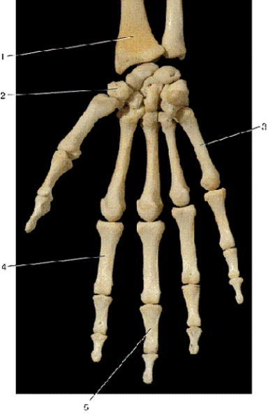 -In the above anterior view of the right hand,number 2 indicates what bone?