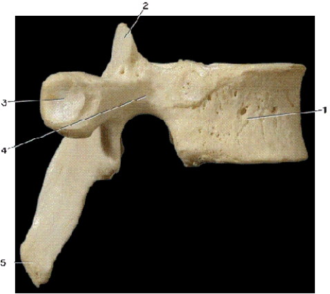 <strong> In the above right lateral view of a vertebra,number 2 indicates what bony landmark?</strong> A)superior articular process B)pedicle C)inferior articular process D)lamina