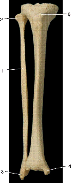 -In the above anterior view of the right leg bones,number 5 indicates what bony landmark?