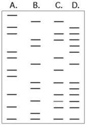 Use the following figure to answer the questions below. The DNA profiles that follow represent four different individuals. -Which of the following statements is most likely true?