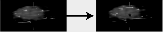 Explain the process of protostar formation shown in the figure below.