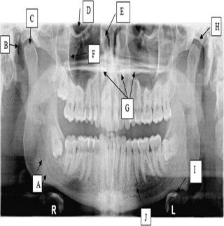 <strong>Use the image to answer the following questions. Hard palate</strong> A)Label A B)Label C C)Label E D)Label G