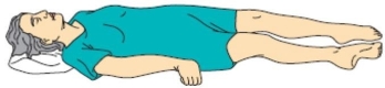 <strong>The nurse becomes concerned when a client who sustained a head injury from a motor vehicle crash begins to demonstrate an abnormal posture.(See image).What does this posture suggest to the nurse about the client's brain functioning? </strong> A) Altered level of consciousness B) Developing a seizure disorder C) Brain stem impairment D) Corticospinal tract impairment