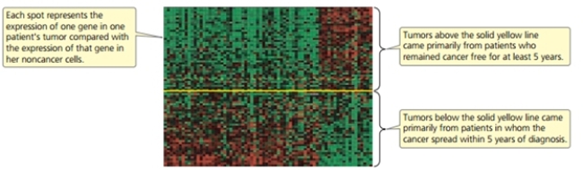 <strong>The following is a microarray that includes genes identified in breast cancer tumors.Why is this gene expression pattern important?   [Reprinted by permission from Macmillan Publishers Ltd.L.J.van'T Veer et al., Gene expression profiling predicts clinical outcome of breast cancer,  Nature 405:532.© 2002.]</strong> A)It can tell us something about which genes are involved in more invasive or aggressive breast cancer. B)It can tell us the prognosis of new patients. C)It can tell us which mutations caused the cancer. D)It can show us which cDNA is better for diagnosing cancer. E)It can both tell us something about which genes are involved in more invasive or aggressive breast cancer and tell us the prognosis of new patients. <div style=padding-top: 35px> 