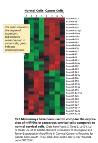 <strong>In the figure, it is MOST likely that: </strong> A)the top 18 miRs should be turned off to treat the cancer. B)the bottom 15 miRs should be turned on to treat the cancer. C)the top 18 miRs should be turned on to treat the cancer. D)the top 18 miRs should be turned off and the bottom 15 miRs should be turned on to treat the cancer. E)both the bottom 15 miRs and the top 18 miRs should be turned on to treat the cancer.