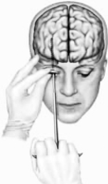   -This drawing illustrates
