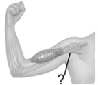 <strong> The patellar tendon reflex is a</strong> A) withdrawal reflex. B) reciprocal reflex. C) stretch reflex. D) recurrent reflex. E) multisynaptic reflex.