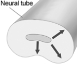 <strong> The pattern of neural migration that is indicated by the arrows in this illustration is</strong> A) radial. B) tangential. C) inside out. D) outside in. E) posterior.
