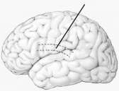 -Which component of the Wernicke-Geschwind model is illustrated here?