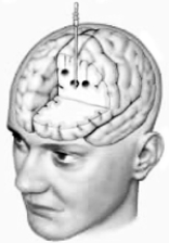 <strong>In 1949, Egas Moniz was awarded the Nobel Prize for  </strong> A) demonstrating that the two cerebral hemispheres have different functions. B) writing The Organization of Behavior. C) research on the visual system. D) studies of hormone production by the brain. E) none of the above <div style=padding-top: 35px> 