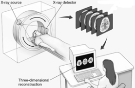 <strong>Which technique is illustrated here? </strong> A) computed tomography B) cerebral angiography C) electroencephalography D) magnetic resonance imaging E) positron emission tomography