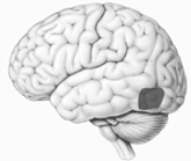 What neuropsychological disorder is associated with damage to the illustrated cortical area?