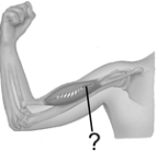 <strong>The muscle at the end of the pointer line is </strong> A) an intrafusal muscle. B) an extrafusal muscle. C) a skeletal muscle. D) both A and C E) Both B and C