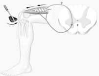 <strong>Illustrated here is a </strong> A) patellar tendon reflex. B) withdrawal reflex. C) stretch reflex. D) both A and B E) both A and C