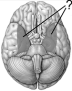 <strong>The shaded areas on this drawing of the inferior surface of the brain illustrate the position of the </strong> A) hippocampuses. B) amygdalas. C) striatums. D) medial parietal lobes. E) medial temporal lobes.