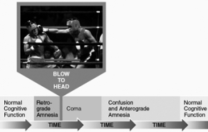 <strong>Illustrated here is the time course of events occurring before and after </strong> A) concussion. B) contusion. C) consolidation. D) islands of memory. E) none of the above
