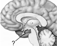 <strong>Which structure is indicated here? </strong> A) anterior pituitary B) posterior pituitary C) hypothalamus D) mammillary body E) pineal