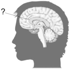 <strong>The cerebral commissure indicated here is the </strong> A) corpus callosum. B) posterior commissure. C) anterior commissure. D) hippocampal commissure. E) massa commissura.