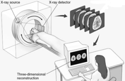 <strong>Which technique is illustrated here? </strong> A) computed tomography B) cerebral angiography C) electroencephalography D) magnetic resonance imaging E) positron emission tomography