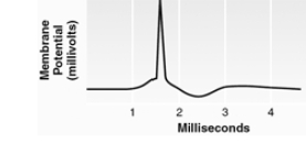 <strong>Which method was used to record this signal? </strong> A) extracellular unit recording B) intracellular unit recording C) electroencephalography D) integrated multiple unit recording E) plethysmography