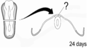 <strong>At 24 days after conception,the precursor of the PNS is visible in the developing embryo,just dorsal to the developing spinal cord.This structure,which is illustrated here at the end of the pointer line,is the neural </strong> A) tube. B) plate. C) crest. D) groove. E) stem.