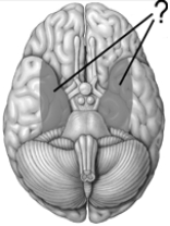 <strong>The shaded areas on this drawing of the inferior surface of the brain illustrate the position of the </strong> A) hippocampuses. B) amygdalas. C) striatums. D) medial parietal lobes. E) medial temporal lobes.