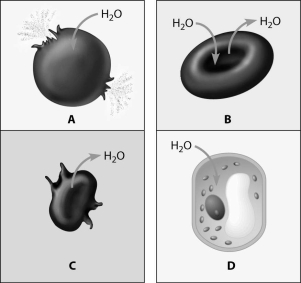 <strong>Which figure depicts an animal cell placed in a solution hypotonic to the cell? </strong> A)cell A B)cell B C)cell C D)cell D