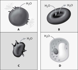 <strong>Which figure depicts an animal cell placed in a solution hypotonic to the cell? </strong> A)cell A B)cell B C)cell C D)cell D