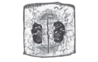 <strong>What event will immediately follow the event shown in this image? </strong> A)The cell will divide into two animal cells. B)The cell will divide into two plant cells. C)The cell will divide into four animal cells. D)The cell will divide into four plant cells.