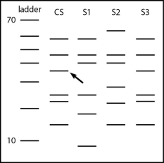 Use the figure below to answer the following question. The bands in the ladder are in 10-base increments, starting with 10 bases at the bottom and going to 70 bases at the top. CS, crime scene; S1, suspect 1; S2, suspect 2; S3, suspect 3. Which suspect is likely to have committed the crime?