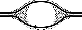 <strong> Grains represent radioactive material within the replicating eye. In an experiment, DNA is allowed to replicate in an environment with all necessary enzymes, dATP, dCTP, dGTP, and radioactively labeled dTTP (³H thymidine)for several minutes and then switched to nonradioactive medium. It is then viewed by electron microscopy and autoradiography. The figure above represents the results. Which of the following is the most likely interpretation?</strong> A) There are two replication forks going in opposite directions. B) Thymidine is only being added where the DNA strands are furthest apart. C) Thymidine is only added at the very beginning of replication. D) Replication proceeds in one direction only.