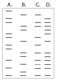 <strong>Use Figure 20.3 to answer the following questions. The DNA profiles that follow represent four different individuals.   Figure 20.3 Which of the following statements is consistent with the results?</strong> A) B is the child of A and C. B) C is the child of A and B. C) D is the child of B and C. D) A is the child of B and C. E) A is the child of C and D. <div style=padding-top: 35px> 