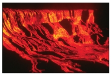 <strong>Comparing these two photographs,which eruption has lower viscosity magma? </strong> A)the fluid cascade of lava B)the circular volcanic feature C)they could have the same viscosity D)there is no way to tell