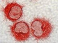 <strong>The cell type shown below is found between follicles in lymph nodes and expresses B7-1,B7-2,and class II MHC.What type of cell is this? </strong> A)B cell B)Follicular dendritic cell C)Thymic epithelial cell D)Dendritic cell E)Plasma cell