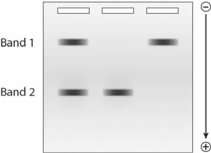 Given the following gel, which DNA fragment has a lower molecular mass?