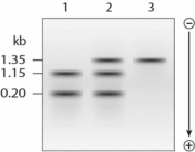 Given the following Southern blot results, which lane represents a heterozygous individual?