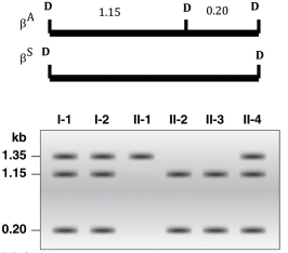 A restriction map of β<sup>A</sup> and β<sup>S</sup> is shown. Members of a family were analyzed by cutting their DNA with DdeI. Which individuals in the family have the genotype β<sup>A</sup>β<sup>A?</sup>