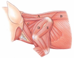 <strong>Identify the longissimus dorsi in the following figure. </strong> A) A B) B C) C D) D E) E