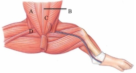 <strong>Identify the linea alba in the following figure. </strong> A) A B) B C) C D) D