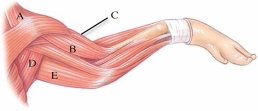 <strong>Identify the brachialis in the following figure. </strong> A) A B) B C) C D) D E) E