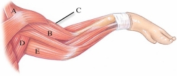 <strong>Identify the brachiocephalic. </strong> A) A B) B C) C D) D E) E