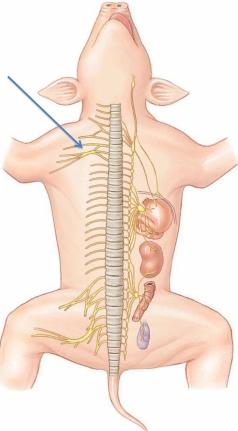 <strong>Identify the nerve plexus at the tip of the arrow in the following figure. </strong> A) sacral plexus B) brachial plexus C) lumbar plexus D) cervical plexus