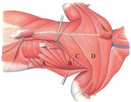 <strong>Identify the serratus ventralis in the following image.  </strong> A) A B) B C) C D) D <div style=padding-top: 35px> 