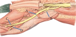 <strong>Identify the common fibular nerve in the following figure.  </strong> A) A B) B C) C D) D <div style=padding-top: 35px> 