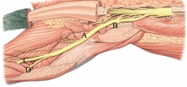 <strong>Identify the sciatic nerve in the following figure.  </strong> A) A B) B C) C D) D <div style=padding-top: 35px> 