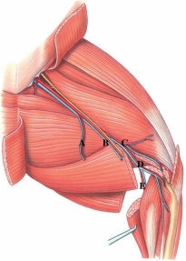 Identify the deep femoral artery in this figure.  