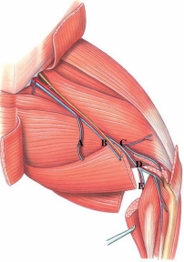 Identify the deep popliteal artery in the figure.  