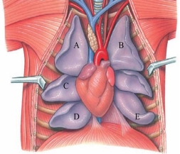 Identify the caudal lobe of the right lung in the figure.  